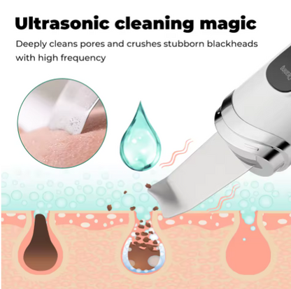 Espátula Ultrasónica Skyn Care